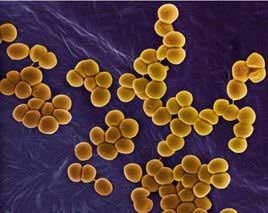 Methicillin Resistant Staphylococcus aureus (MRSA)